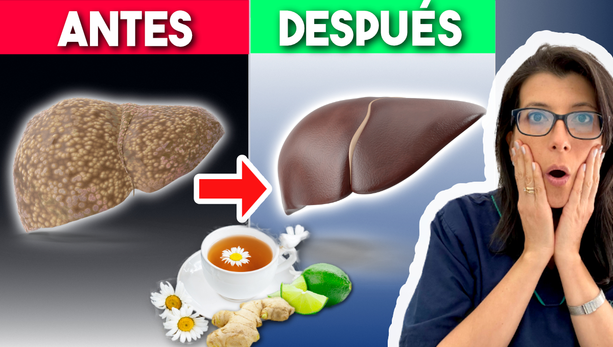 DUERME y DESINTOXICA tu HÍGADO DUERME y DESINTOXICA tu HÍGADO